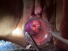 Electrosounding of shaved genitals with speculum