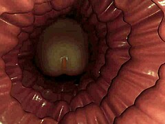 في هذه الحلقة من كام فليشن 75، شخصية حامل تختبر لقاءات مرحاض مكثفة مع مواضيع توسع.