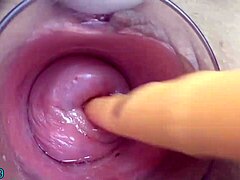 밀프 자궁경부 박기