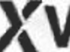 Monster Anal Prolapse