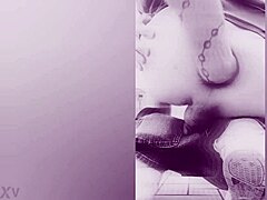 anal fisting prolapse