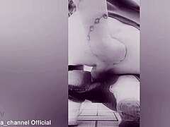 anal fisting prolapse