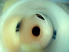 Endoscopic Double Cum