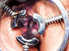 milf speculum fist